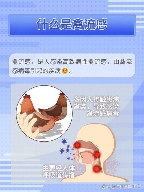 禽流感潜伏期：了解禽流感的传播特点